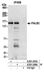 PALB2 Antibody in Immunoprecipitation (IP)