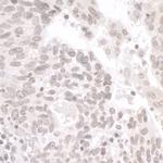 PALB2 Antibody in Immunohistochemistry (Paraffin) (IHC (P))