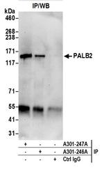 PALB2 Antibody in Immunoprecipitation (IP)