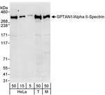 SPTAN1/Alpha II-spectrin Antibody in Western Blot (WB)