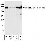SPTAN1/Alpha II-spectrin Antibody in Western Blot (WB)