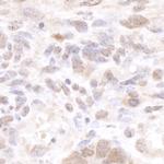 CSTF50 Antibody in Immunohistochemistry (Paraffin) (IHC (P))