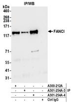 FANCI Antibody in Immunoprecipitation (IP)