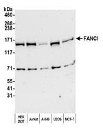 FANCI Polyclonal Antibody