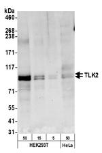 TLK2 Polyclonal Antibody