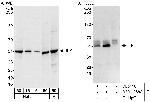 ILK Antibody in Western Blot (WB)