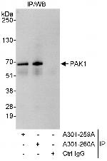 PAK1 Polyclonal Antibody