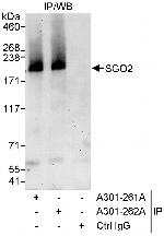 SGO2 Polyclonal Antibody