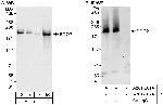 SGO2 Polyclonal Antibody