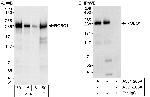 ROBO1 Polyclonal Antibody