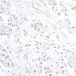 INT11 Polyclonal Antibody