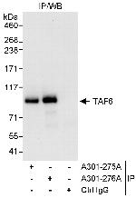 TAF6 Polyclonal Antibody