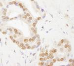 TAF6 Polyclonal Antibody