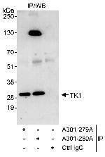 TK1 Polyclonal Antibody