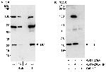 TK1 Polyclonal Antibody