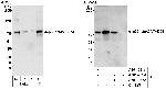 p66beta/GATAD2B Antibody in Western Blot (WB)