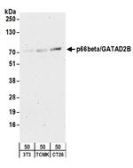p66beta/GATAD2B Polyclonal Antibody