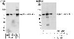 p66beta/GATAD2B Antibody in Western Blot (WB)