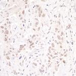 p66beta/GATAD2B Polyclonal Antibody