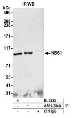 NBS1 Antibody in Immunoprecipitation (IP)