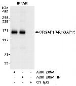 SRGAP1/ARHGAP13 Antibody in Immunoprecipitation (IP)