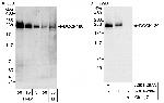 DOCK180 Polyclonal Antibody