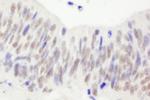 NBS1 Polyclonal Antibody
