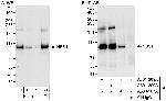 NBS1 Antibody in Western Blot (WB)