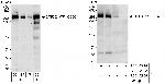 GTF3C1/TFIIIC220 Antibody in Western Blot (WB)