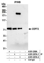 CEP72 Antibody in Immunoprecipitation (IP)