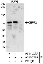 CEP72 Polyclonal Antibody