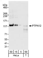 PTPN12 Polyclonal Antibody
