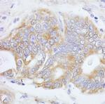 PTPN12 Polyclonal Antibody