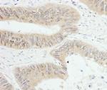 PTPN12 Polyclonal Antibody