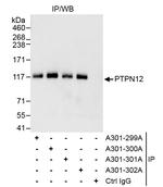 PTPN12 Antibody in Immunoprecipitation (IP)