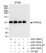 PTPN12 Antibody in Immunoprecipitation (IP)