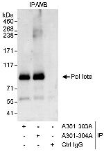 Pol Iota Polyclonal Antibody