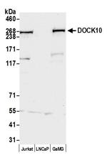 DOCK10 Polyclonal Antibody