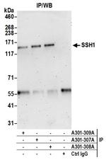 SSH1 Antibody in Immunoprecipitation (IP)
