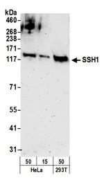 SSH1 Polyclonal Antibody