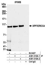 XPF/ERCC4 Antibody in Immunoprecipitation (IP)