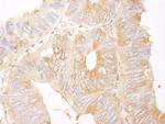 Coronin 2 Polyclonal Antibody