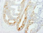 FASN Polyclonal Antibody