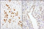 GTF2I/TFII-I Polyclonal Antibody