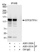 GTF2I/TFII-I Antibody in Immunoprecipitation (IP)