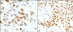 GTF2I/TFII-I Polyclonal Antibody
