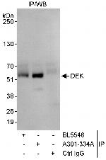 DEK Antibody in Immunoprecipitation (IP)