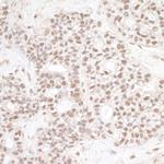 ERCC3 Polyclonal Antibody