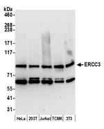 ERCC3 Polyclonal Antibody