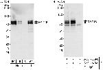 Rad18 Polyclonal Antibody